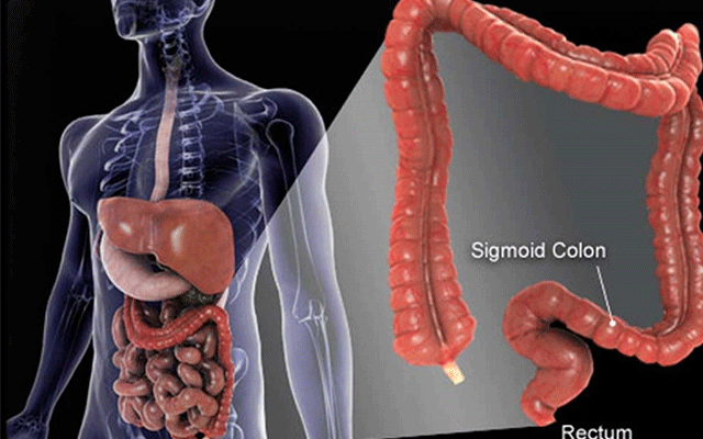 Four-major-symptoms-of-colorectal-cancer-01